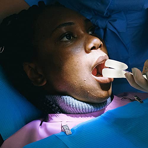 Sağlıklı 3 adet Ağız Açacağı Ağız Toplayıcı Oral Ağız Prop Bite Blokları Diş Hekimi Diş Beyazlatma Parti Ağızlık Mücadelesi